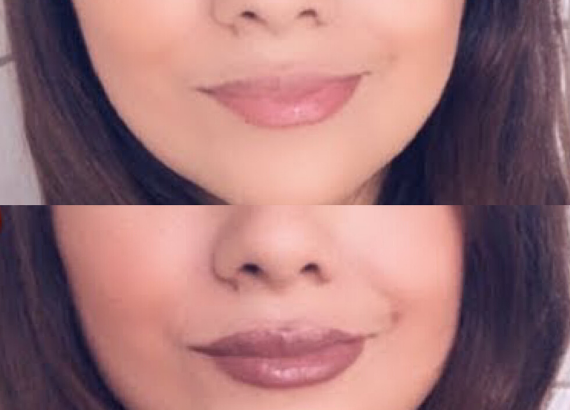 Comment avoir des lèvres plus pulpeuses sans chirurgie ?